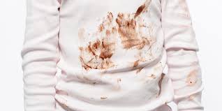 Chocolate Stain Removal